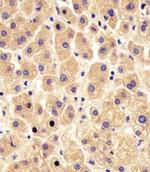 PYGL Antibody in Immunohistochemistry (IHC)