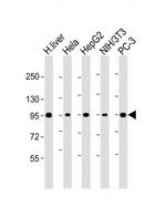 PYGL Antibody in Western Blot (WB)