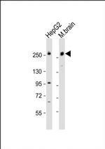 RALGAPA1 Antibody in Western Blot (WB)
