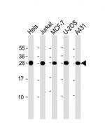 RPL14 Antibody in Western Blot (WB)