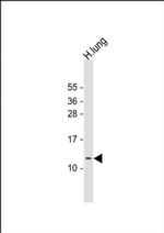 DKK3 Antibody in Western Blot (WB)