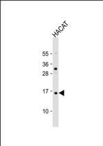 TCTA Antibody in Western Blot (WB)