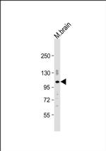 PDE2A Antibody in Western Blot (WB)