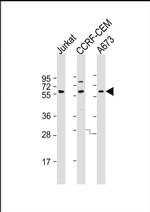 CESK1 Antibody in Western Blot (WB)