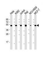 RPL4 Antibody in Western Blot (WB)