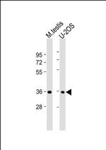 HEXIM2 Antibody in Western Blot (WB)