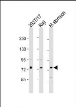 PLA2G4F Antibody in Western Blot (WB)