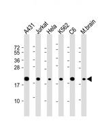 RPS10 Antibody in Western Blot (WB)