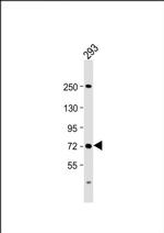 SLC6A19 Antibody in Western Blot (WB)