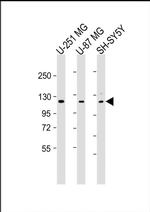 SH3PXD2B Antibody in Western Blot (WB)