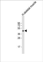 ERVK-21 Polyclonal Antibody