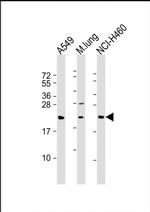 TUSC1 Antibody in Western Blot (WB)