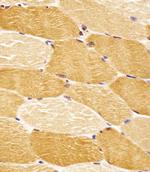 ENT2 Polyclonal Antibody