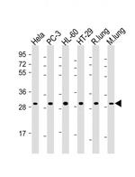 RPS4X Polyclonal Antibody