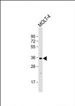 GLT6D1 Antibody in Western Blot (WB)