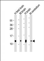 GNG3 Antibody in Western Blot (WB)