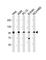 PCSK1 Antibody in Western Blot (WB)