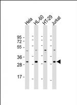 CSN7b Antibody in Western Blot (WB)