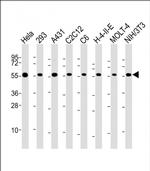 RAD21 Antibody in Western Blot (WB)