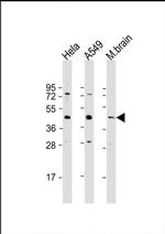 G6PC3 Antibody in Western Blot (WB)