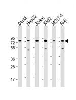 PABPC3 Antibody in Western Blot (WB)