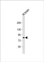 CIP2A Polyclonal Antibody