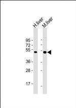 CTBS Antibody in Western Blot (WB)