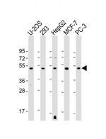 EEF1A1P5 Antibody in Western Blot (WB)