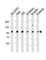 PGAP1 Antibody in Western Blot (WB)