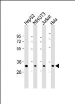 RPS2 Antibody in Western Blot (WB)