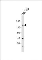 ADAMTS20 Antibody in Western Blot (WB)