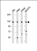 INTS3 Antibody in Western Blot (WB)