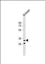 TMEM106B Antibody in Western Blot (WB)