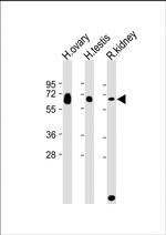 GGT3P Polyclonal Antibody