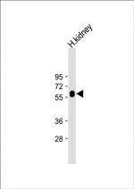 GGT3P Polyclonal Antibody