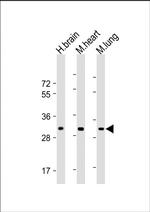 CH25H Polyclonal Antibody