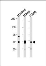 DLL4 Antibody in Western Blot (WB)