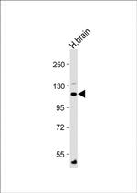 ATP1A4 Polyclonal Antibody