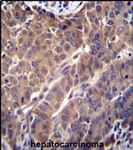 ARL2 Antibody in Immunohistochemistry (IHC)