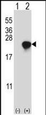 ARL2 Antibody in Western Blot (WB)