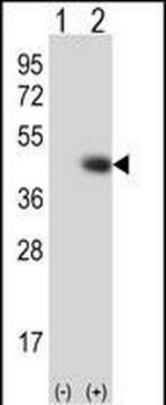 TPST1 Polyclonal Antibody