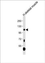 LGR5 Antibody in Western Blot (WB)