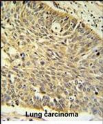 MTHFD1 Antibody in Immunohistochemistry (IHC)