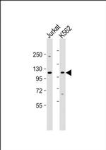 MTHFD1 Antibody in Western Blot (WB)