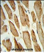 POLG2 Antibody in Immunohistochemistry (IHC)