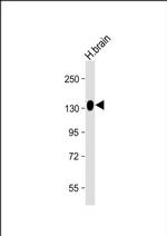 ENPP2 Antibody in Western Blot (WB)