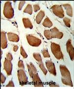 GST Omega 1 140A Antibody in Immunohistochemistry (IHC)