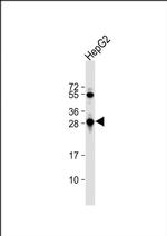 GST Omega 1 140A Antibody in Western Blot (WB)