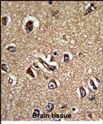 STRAP Antibody in Immunohistochemistry (IHC)