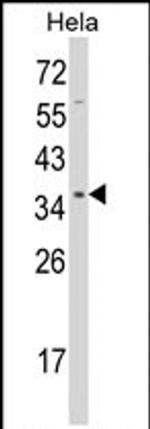 STRAP Antibody in Western Blot (WB)